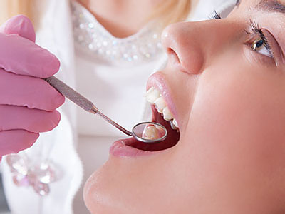 A dental professional is performing a teeth cleaning procedure on a patient s mouth.